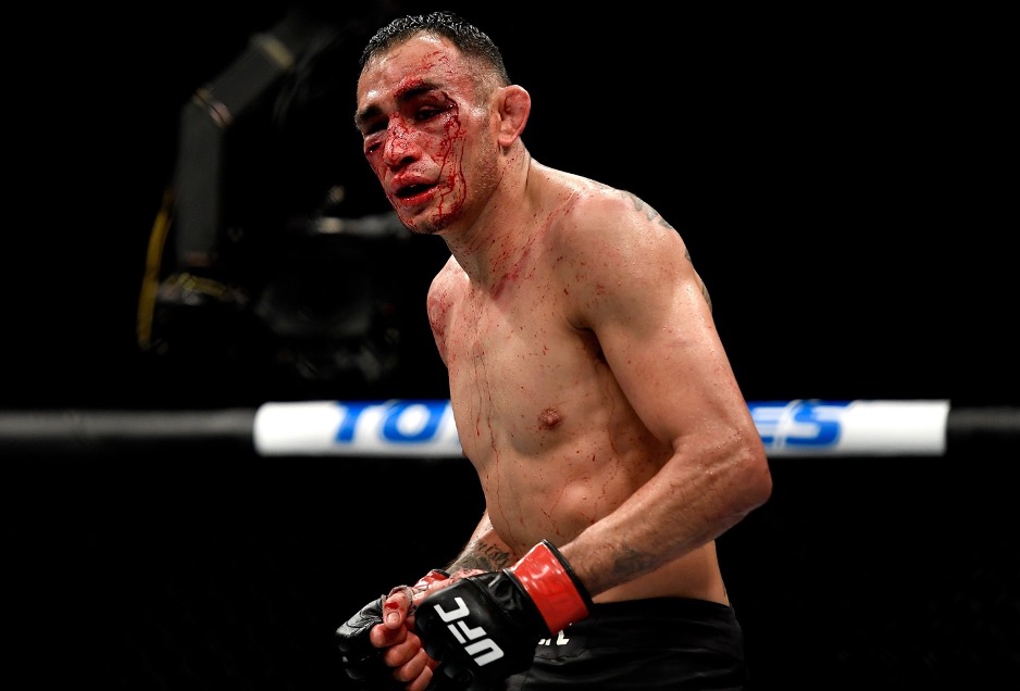  Tony Ferguson has been taken to hospital following his defeat to Justin Gaethje at UFC 249